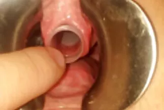 تغلب قصص عربي محارم الأنثى على الذكر